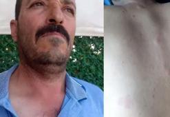 Duyduğu sesler az daha canından ediyordu! Kurtuldum sandı derken yakalandı