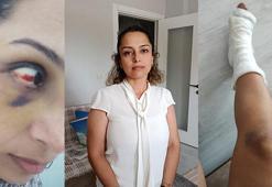 Adana'daki öğretmenin kabusu! ‘Ne canını ne de malını koruyabiliyor'