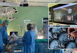 Tümörü yüzde 98 doğrulukla temizliyor! Beyin ameliyatlarında yapay zeka mucizesi: Türk bilim insanları dünyaya örnek oldu