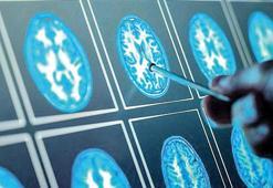 5 duyuda bunama belirtisi