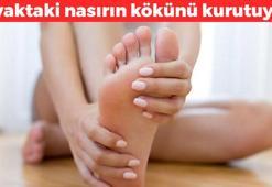 Ayaktaki nasırın kökünü kurutuyor! 1 gece sürüp bekletin