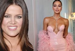 Khloe Kardashian yaptırdığı estetikleri tek tek anlattı! Saç çizgisinden, somon spermine her şey var!