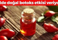 Botokstan çok daha etkili! Kırışıkları santim santim açıp erkenden yaşlanmayı engelliyor, tek gecede 10 yaş birden gençleştiriyor!