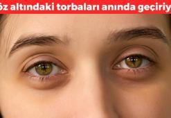Göz altı morluklarını geçiren yöntem! Birkaç dilim koymak yeterli oluyor: Halka izlerini dakikalar içerisinde geçiriyor, şişliğini indiriyor