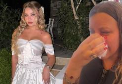 Fenomen Mika Raun, Dubai'de kaza geçirdi! Kanlar içinde kaldı