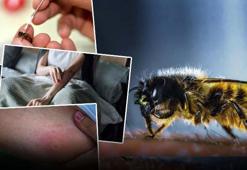 Fransa'da arı paniği! 24 kişi yaralandı, 78 yaşındaki kadını tam 25 kere soktu! Uzmanlar uyardı: İlk 30 dakika kritik öneme sahip