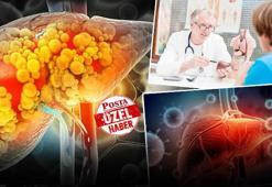 Belirti dahi vermeden sinsice ilerliyor, her 3 kişiden 1'inde var! Uzman isim uyardı: Tedavi edilmezse sirozla sonuçlanabilir!