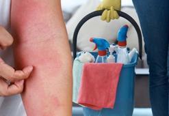 Evdeki sabun ve deterjan etiketlerinde yazıyorsa hemen çöpe atın! Cildi mahvedip egzamaya neden oluyor, elleri 10 yıl yaşlandırıyor!