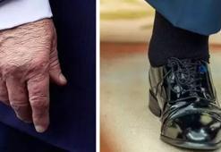 ABD Başkanı Trump'ın gizemli hastalığı ortaya çıktı!