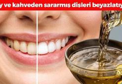 İnci gibi dişlerin sırrı! Çay ve kahveden sararmış dişleri anında beyazlatıyor: Ağız içerisinde plak ve bakterileri de yok edip gülüşünüzü ışıl ışıl yapıyor!