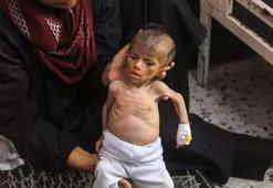Gazze’de bebekler açlıktan can veriyor! Yardım çağrısı