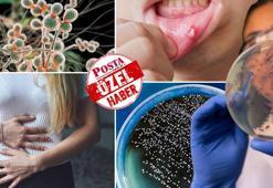 Her 4 kadından 3'ü en az bir kere yaşıyor! Tekrarlayan enfeksiyonlar dikkate alınmalı