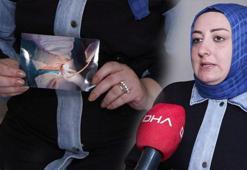 Doğum yapan kadının karnında 15 cm'lik hortum unuttular! Doktorun skandal savunması şoke etti