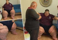 270 kiloluk bedeniyle çaresiz bekleyiş içinde! Fil hastalığı hayatını 'felç' etti: 15 aydır evden çıkamıyor