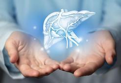 'Sessiz ama ölümcül bir pandemi' olarak kabul ediliyor! Uzman isim açıkladı: Karaciğer kanseri vakalarının en az yüzde 60’ı önlenebilir