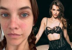 Barbara Palvin yıllar süren ağrılarının nedenini açıkladı! 'Erken teşhis çok önemli'