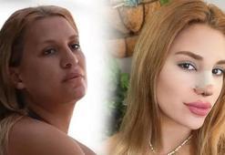 Survivor Almeda Baylan kaza geçirdi! Takla atan araç alev alev yandı