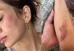 Köpek besledi, saldırıya uğradı: Veterinerin annesi 10 metre sürüklendi