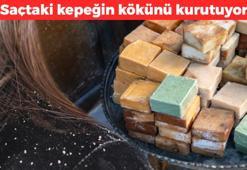 Kalıp kalıp alıp eve koyun! Bir kere deneyen marketten almayı bırakıyor: Sivilcelerin kökünü kurutuyor, kepeği bir gecede gideriyor