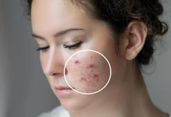 Selfie ile gerçek yüz arasındaki fark: Estetik algıyı nasıl etkiliyor?