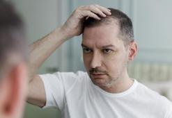 Mevsimsel saç dökülmesi normal ancak kesinlikle ihmal edilmemeli!
