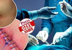 Karın duvarında gizlenen tehlike! Ameliyat sonrasında ortaya çıkabiliyor