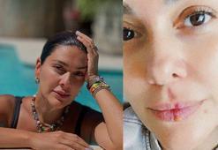 Bergüzar Korel'den makyajsız poz! Tüm dertleri yüzüne vurdu