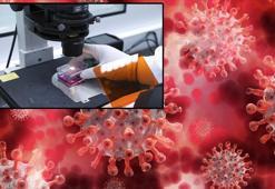 Türkiye’de ‘maymun çiçeği virüsü’ iddiası! İngiltere’den seyahat uyarısı