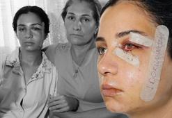 Genç kadına cehennemi yaşatmıştı: Eski eş dehşetinde flaş karar