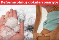 Doğal yoldan selüliti gideriyor! 80’den fazla mineral barındırıyor: Deforme olmuş dokuları onarıyor
