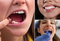 5 yıl içerisinde yeni diş çıkartmak mümkün olacak! Araştırma sonuçları umut verici, bilim dünyasını sarsan gelişme...