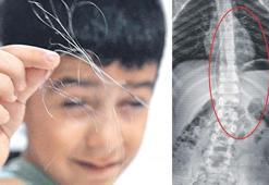 Hastanedeki unutkanlık hayatını karattı