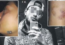 Şiddet gören kadına mahkmeden şok karar! Kıskançlığı 'kusur' sayıldı