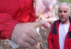 Bolu’da fındık bahçesinde ayı saldırısı! Parmağını kaybeden adam yaşadıklarını anlattı