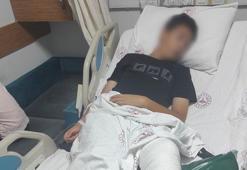 Özel okulda zorbalık iddiası! Öğrencinin bacağı kırıldı