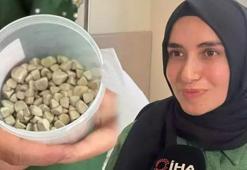 Doktorları şaşkına çeviren olay: Hepsi vücudundan çıktı, tam 287 adet! ‘Bu kadar beklemiyorduk’