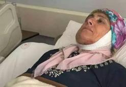 54 yaşındaki kadın, 15 yıl sonra ilk kez gülümsedi