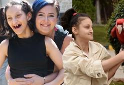 Asya’ya evde eğitim yolu kapandı! Anne isyan etti: Geri dönüşü olmayan hastalığa her yıl rapor isteniyor