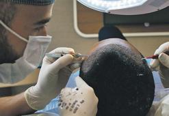 Saç ekimini yabancıya öğretip sağlık turizmini baltalıyorlar