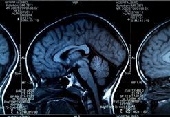 40 yaşındaki herkes yaptırmalı! Erken teşhis çok önemli