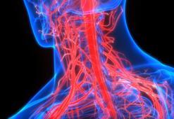 'Şah damarı hastalıkları felç riskini artırıyor'