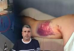 Dededen kalan miras hayatını altüst etti: 'Artık arkama baka baka yürüyorum'