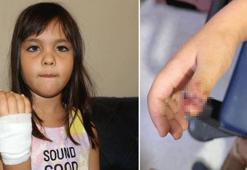 Anaokulunda korkunç olay! 4 yaşındaki çocuğun parmağı kapıya sıkışarak koptu