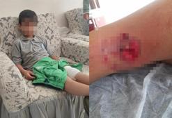 8 yaşındaki çocuk okul yolunda sokak köpeğinin saldırısına uğradı