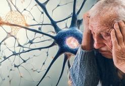Alzheimer’dan 25 yıl önce gelen uyarı: Adres ararken yönünüzü kaybediyorsanız dikkat! Uzmanlardan kritik açıklama