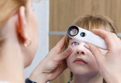 Göz kaşıntısı, sulanma ve kızarıklık geçmiyorsa dikkat! Tedavi edilmeyen alerji göz kuruluğuna yol açabiliyor