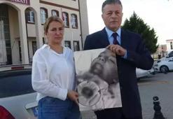 İlkokulda korkunç olay! 7 yaşındaki Kuzey'in çit demiri saplanan çenesi koptu