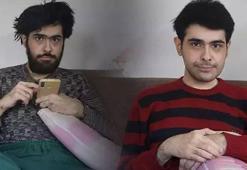 Ne duş alıyor ne tıraş oluyordu! 3 yıl sonra dışarı çıkan Barış’a tanı kondu