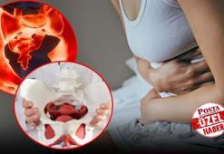 Kasık ve bel ağrısını sakın geçiştirmeyin! Başka rahatsızlıklarla karıştığı için tanısı gecikiyor, şiddetli regl ağrılarının sebebi olabilir!