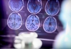 Nöroloji uzmanından inmeye karşı uyarı: Erken müdahale felci önleyebilir
